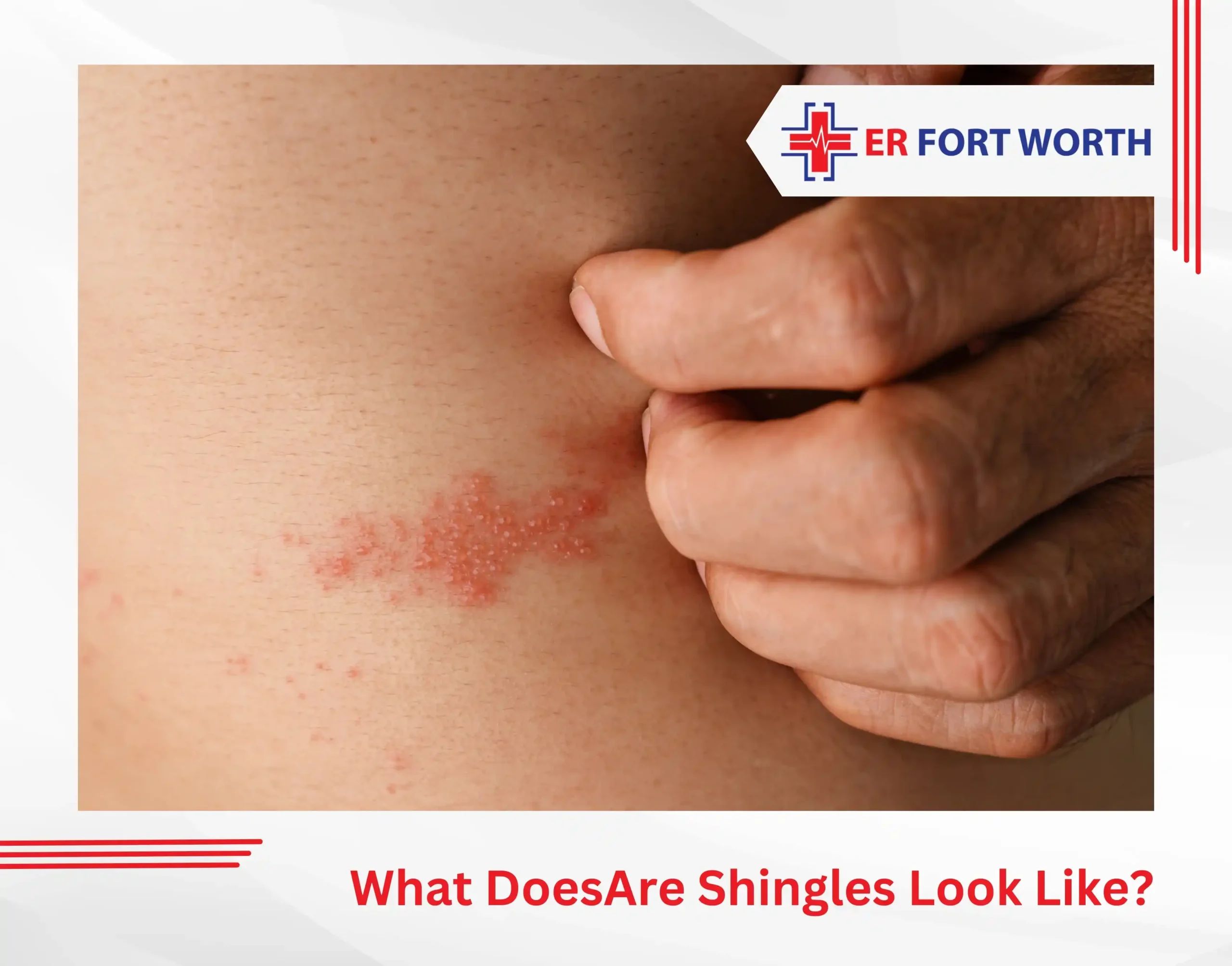 Shingles scars and curling shingles on a roof